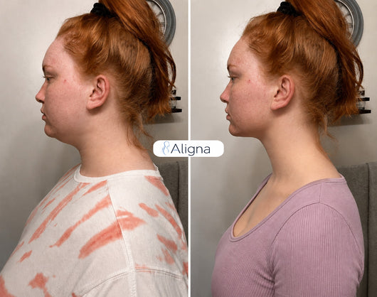 Aligna Dowagers Thera Pillow